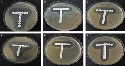 Quinoline Antimalarials Increase the Antibacterial Activity of Ampicillin